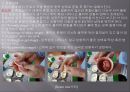 국소의치 - 레진(Resin)주입에서 연마(Polishing) 과정.ppt 9페이지