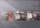 국소의치 - 레진(Resin)주입에서 연마(Polishing) 과정.ppt 10페이지