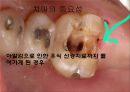 납형제작 기법에 대한 연구.ppt 3페이지