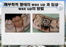 납형제작 기법에 대한 연구.ppt 6페이지