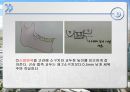 납형제작 기법에 대한 연구.ppt 11페이지