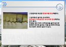 납형제작 기법에 대한 연구.ppt 24페이지