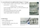 6장 교정장치의 구성요소.ppt 8페이지