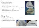 6장 교정장치의 구성요소.ppt 10페이지