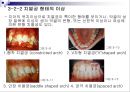 제3장 정상교합과 부정교합.ppt 12페이지