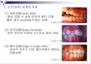 제3장 정상교합과 부정교합.ppt 14페이지