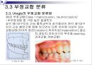제3장 정상교합과 부정교합.ppt 15페이지