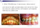 제3장 정상교합과 부정교합.ppt 16페이지