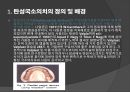 탄성국소의치(Flexible partial denture).ppt 3페이지