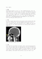 안면골절(facial bone fracture)치료 6페이지