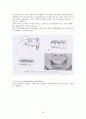 안면골절(facial bone fracture)치료 23페이지
