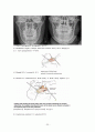 안면골절(facial bone fracture)치료 25페이지