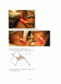 안면골절(facial bone fracture)치료 26페이지