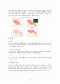 충수절제술(appendectomy)과 수술간호 3페이지