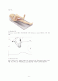 충수절제술(appendectomy)과 수술간호 5페이지
