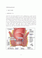 치질(Hemorroid) 2페이지