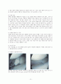 인공슬관절치환술(TKRA)과 간호 13페이지
