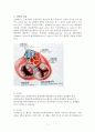 관상동맥우회술(CABG) 5페이지