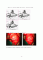 위암(Stomach cancer)과 위절제술(Gastrectomy) 16페이지