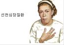 선천심장질환.ppt 1페이지