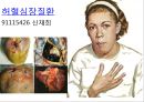 선천심장질환.ppt 5페이지