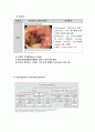 소화성궤양(십이지장궤양) case study 7페이지
