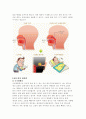 편도선절제술 4페이지