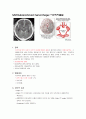 [신경외과] SAH(Subarachnoid hemorrhage) 지주막하출혈 1페이지