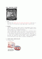 [신경외과] Cbr. infarction 뇌경색 급성뇌경색MRI 1페이지