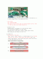 [신경외과] Cbr. infarction 뇌경색 급성뇌경색MRI 5페이지