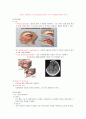 [신경외과] SDH(경막하 출혈, subdural hemorrhage) 3페이지