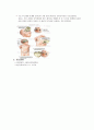 [신경외과] Hydrocephalus(뇌수두증) 5페이지