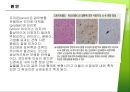 크로이츠펠트-야콥병 8페이지
