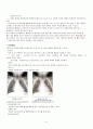 소아과case study-pnuemonia(폐렴)-20쪽 4페이지