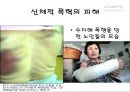 가정폭력 - 가정범죄 지켜보고만 있어야 하나? (가정폭력,가정폭력실태와현황,가정폭력분석,폭력사례,폭력실태,가족폭력,가족폭력실태와현황).PPT자료 27페이지
