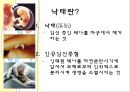 낙태현황,루마니아의낙태현황,4개월3주그리고2일,피임과낙태,여성의낙태 6페이지