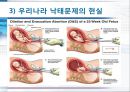 낙태,낙태문제, 문제점, 원인, 실태, 불교사상에서본 낙태문제, 우리나라 낙태실태, 해결방안 11페이지