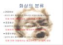 화상아동간호,화상아동,아동화상,화상치료의원칙,화상예방법 6페이지