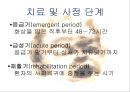 화상아동간호,화상아동,아동화상,화상치료의원칙,화상예방법 8페이지