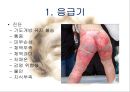 화상아동간호,화상아동,아동화상,화상치료의원칙,화상예방법 13페이지
