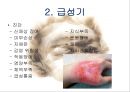 화상아동간호,화상아동,아동화상,화상치료의원칙,화상예방법 14페이지