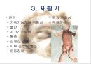 화상아동간호,화상아동,아동화상,화상치료의원칙,화상예방법 15페이지