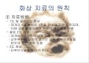 화상아동간호,화상아동,아동화상,화상치료의원칙,화상예방법 18페이지