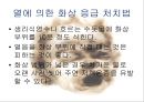 화상아동간호,화상아동,아동화상,화상치료의원칙,화상예방법 19페이지