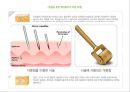 화상아동간호,화상아동,아동화상,화상치료의원칙,화상예방법 22페이지