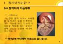 장기이식  7페이지