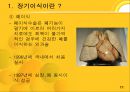 장기이식  11페이지