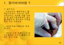 장기이식  13페이지