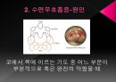수면장애  10페이지