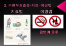 수면장애  11페이지